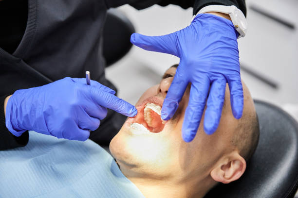 Best Broken or Chipped Tooth Repair in Waverly, VA