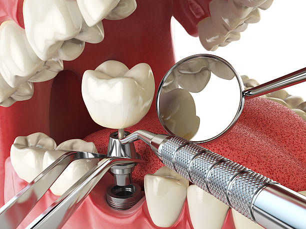 Best Emergency Treatment for Jaw Pain or Injury in Waverly, VA